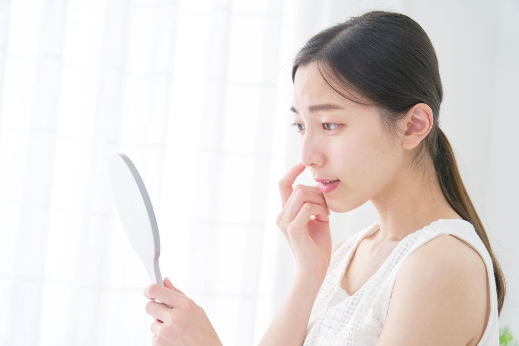 ニキビ 漢方薬