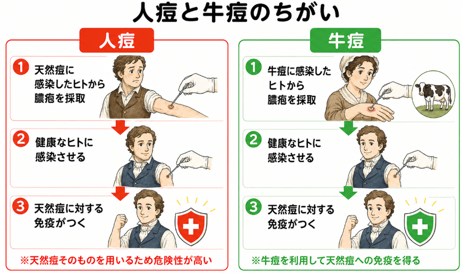 人痘と牛痘の手順の比較をしたイラスト