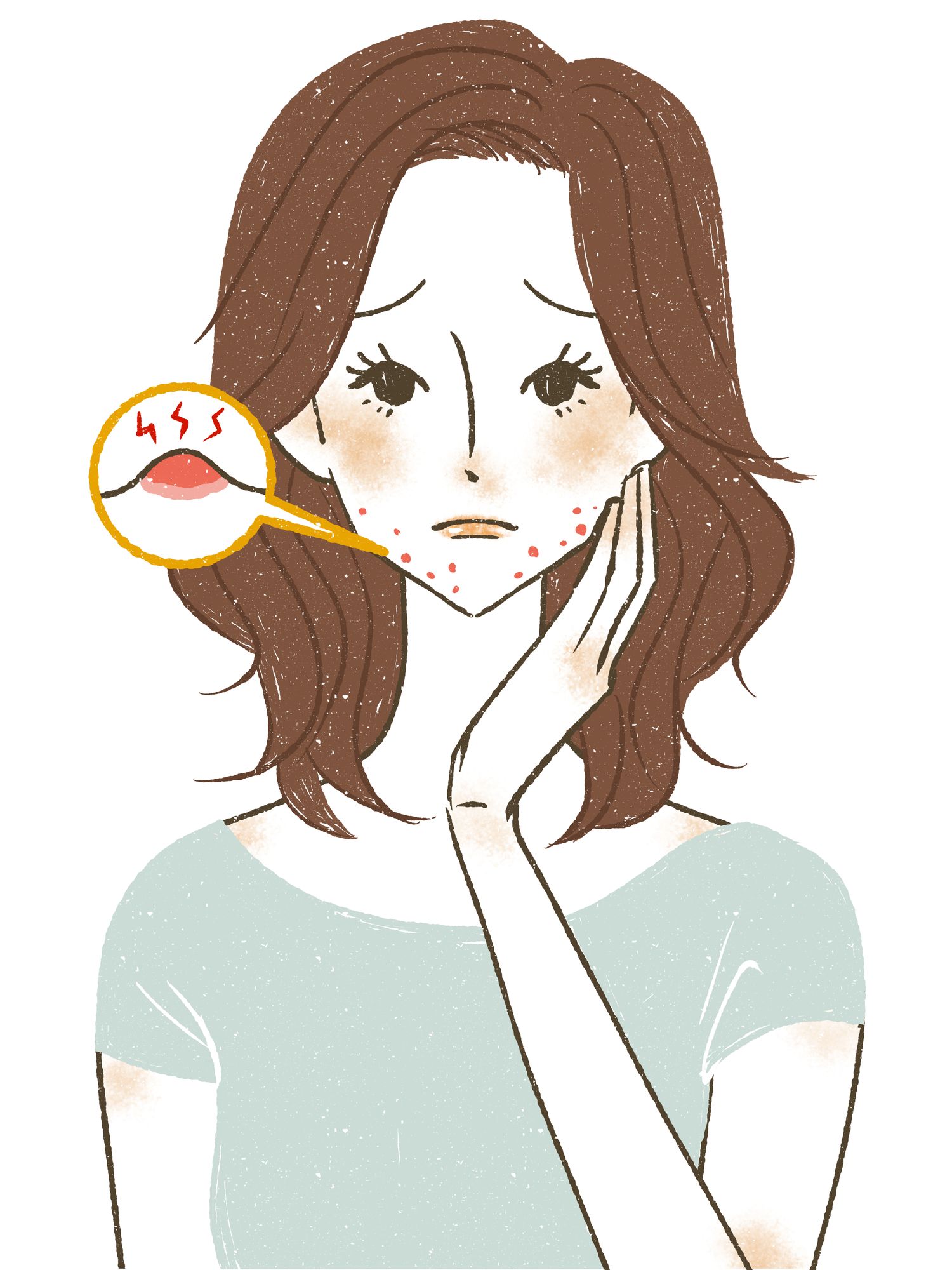ニキビに悩まされる女性のイラスト