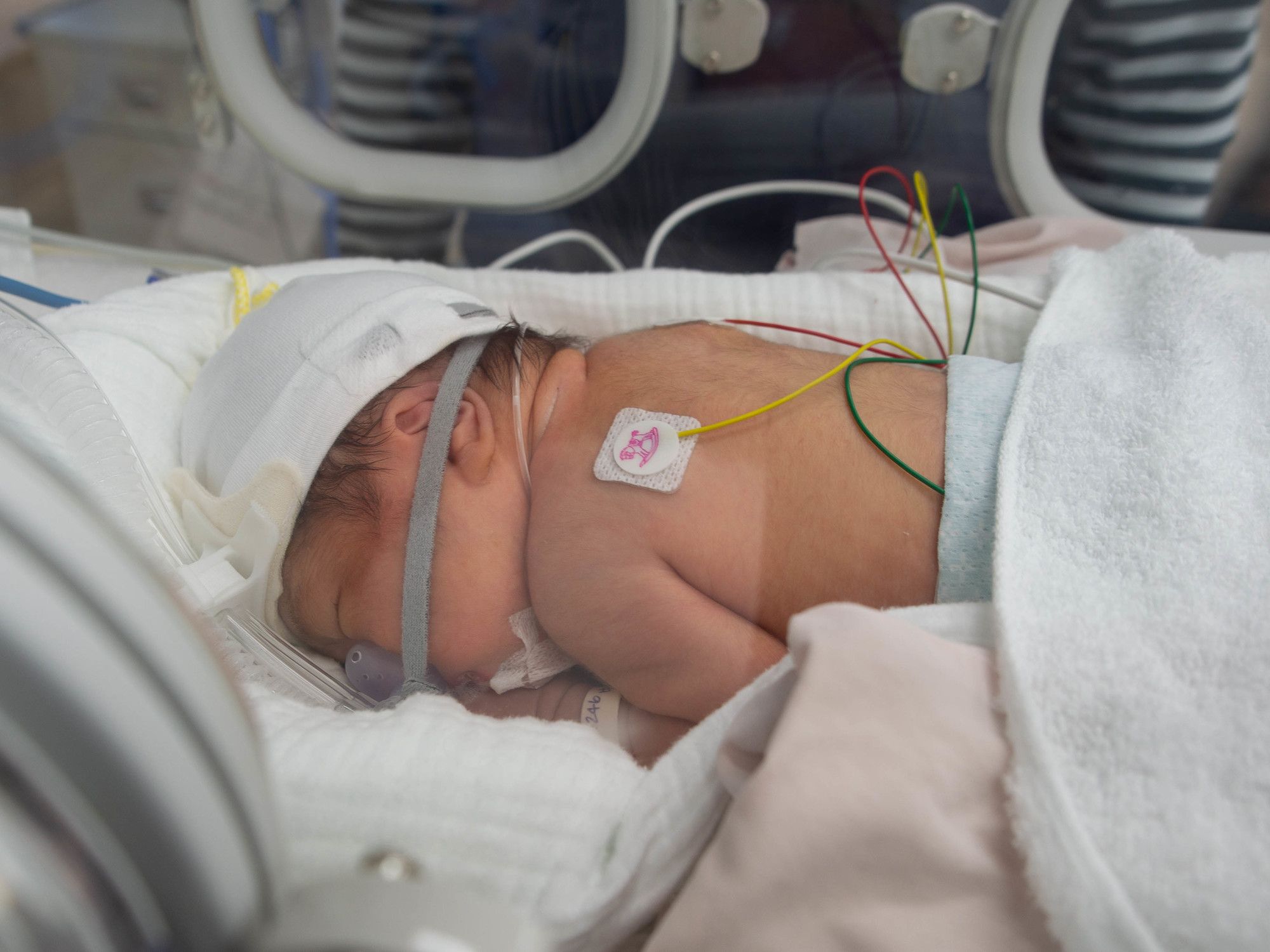小児科病棟でケアを受ける赤ちゃん