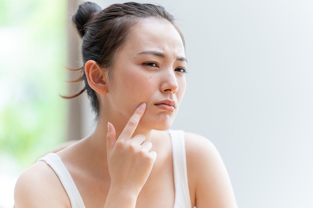 女性　肌荒れ